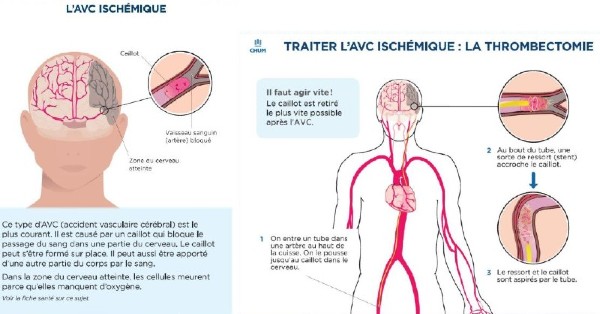 Affiche_informative_600x314.jpg