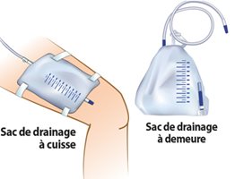 sac-de-drainage.jpg