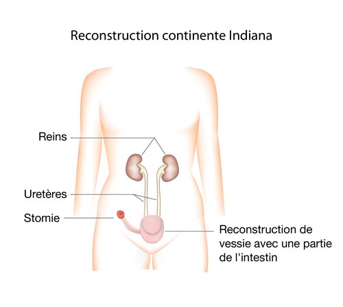 Reconstruction continente Indiana