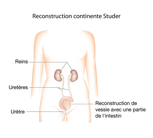 Reconstruction continente Studer